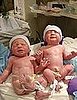 Lil Links: Insider's Look at a C-Section
