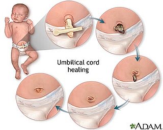 Umbilical Cord Quiz