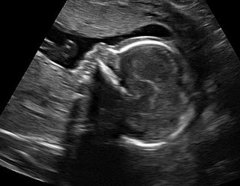 Sharing Ultrasound Pictures Sharing Ultrasound Pictures
