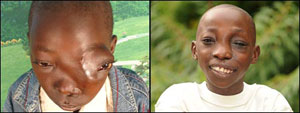 Film Crew Helps Extra with Face Tumor Get a Happy Ending
