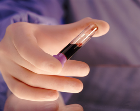 Would You Bank Your Newborn's Cord Blood? 