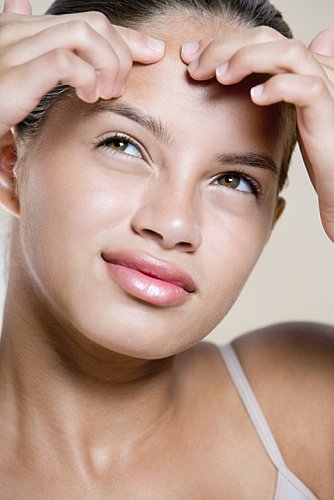 How To Prevent and Cure Blackheads, Spots, Blemishes, Adult Acne. Treatments and Advice