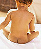 Baby Wellness: Baby's Skin Conditions  