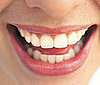 Foods That Help Your Teeth and Gums