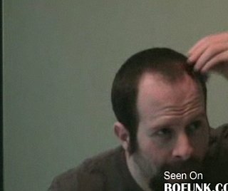 Guy Glues Beard Clippings to His Bald Spots