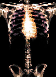 How to Build Stronger Bones