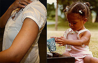 Did You Have a Birthmark? 