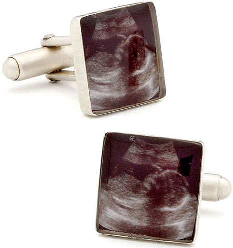 Sonogram Cufflinks: Ga Ga or Gag?