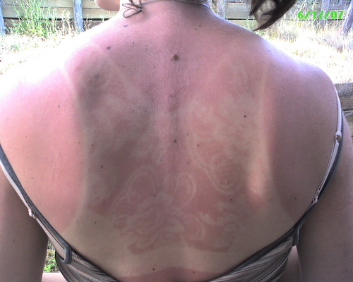 25 Reasons to Not Skip the SPF 25 Reasons to Not Skip the SPF