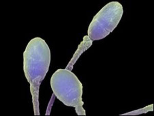 Woman Wins Legal Fight to Harvest Dead Fiance's Sperm
