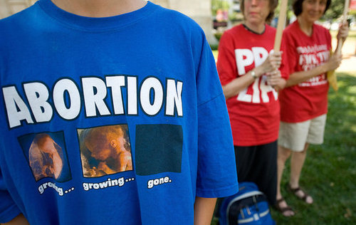 Why Is the Abortion Debate So Extreme in America? 