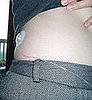 Diabetic Woman Explains the Pros and Cons of Switching to an Insulin Pump