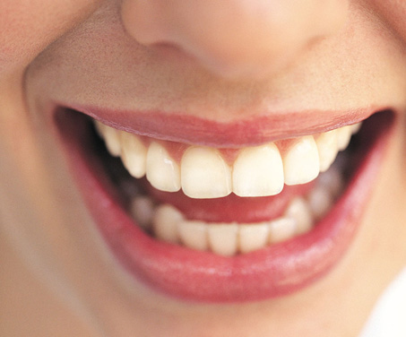 How to Keep your Teeth Pearly White