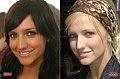 Speak Up: If Cosmetic Surgery Was Cheap, Would You Do It?