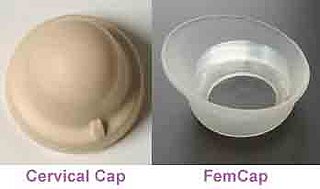 What's the Deal With:  The Cervical Cap?