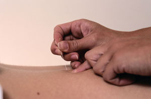 Needles and Back Pain