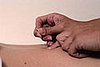 Needles and Back Pain
