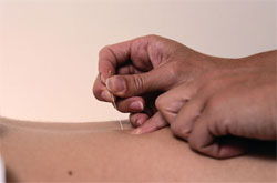 Five Alternative Treatments That Work