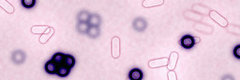 Fittingly Mad: Super Bugs Are Super Scary Fittingly Mad: Super Bugs Are Super Scary
