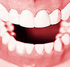 Grinding Your Teeth Causes Serious Dental Health Problems