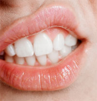 Obesity May Cause Bad Breath