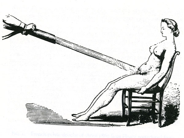vibratorSLIDE_1 vibratorSLIDE_1