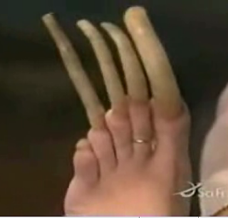 Freakshow Toenail Fun!