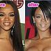 Rihanna had a nose surgery?
