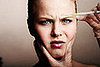 Collagen