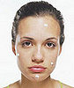 Best of 2007: Acne Fighter