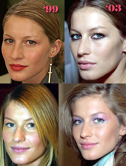 Has Giselle had a nose job?