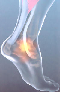 Feet Hurt On Elliptical