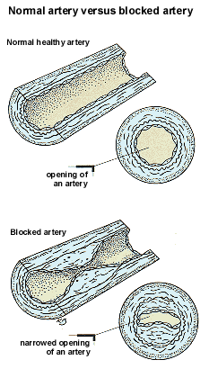 The Good, The Bad and the Healthy: Cholesterol