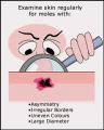 Photograph  Yourself -- Naked!!!  For Medical Reasons