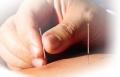 Let's Get to the Point About Acupuncture