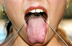 Tongue Scraper