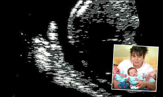 What To (Not) Expect When You're Expecting