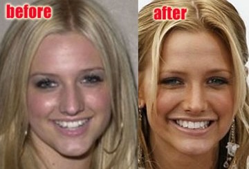 Ashlee Simpson..> More surgery?