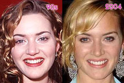 Kate Winslet-- HAD a honker!